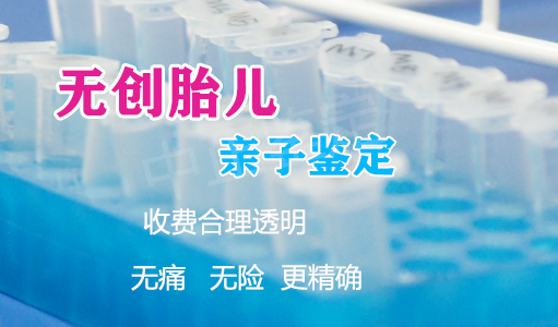 乐山产前亲子鉴定到哪里办理,乐山孕期亲子鉴定出结果时间 乐山产前亲子鉴定到哪里办理,乐山孕期亲子鉴定出结果时间